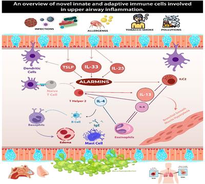 Exploring the immunopathology of type 2 inflammatory airway diseases